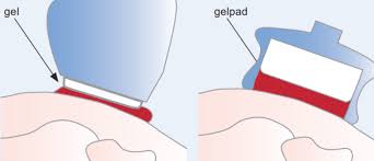 gelpad